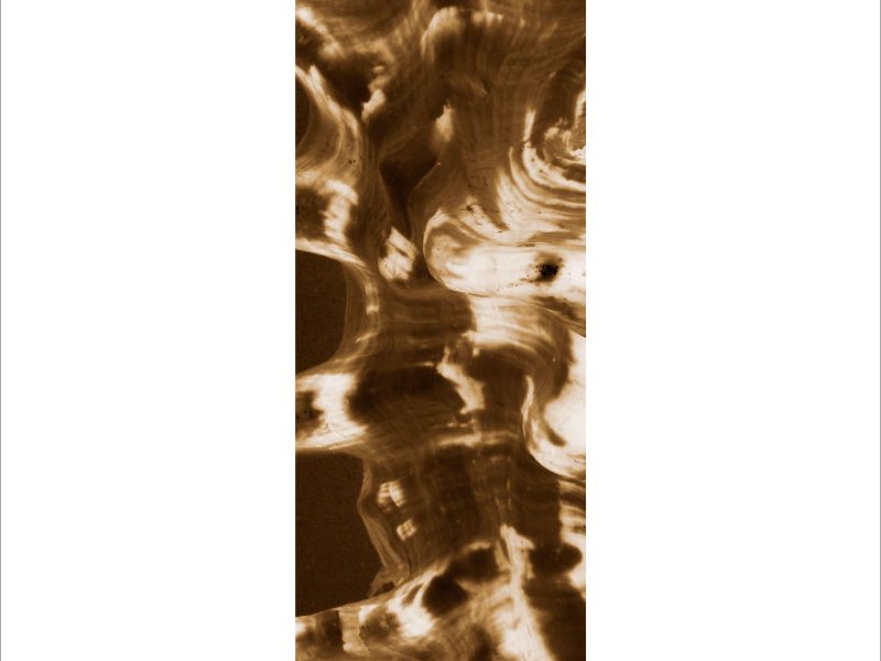 AL02965